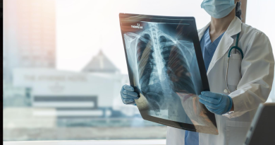 EN SUDAMÉRICA, PESE A CONTAR CON ESPECIALISTAS Y TRATAMIENTOS DISPONIBLES, PERSISTEN LOS RETRASOS EN EL DIAGNÓSTICO Y TRATAMIENTO DE LAS ENFERMEDADES PULMONARES INTERSTICIALES (EPI)